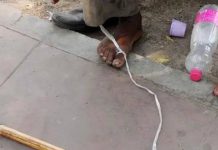 स्नायूंच्या नुकसानापासून ते चयापचयाच्या वाढीपर्यंत: फिटनेस आणि त्वचेचे आरोग्य पुन्हा परिभाषित करणारी एक नॉन-आक्रमक तंत्रज्ञान